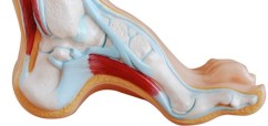 5 fasciitis spurs  and Heel Top for and shoes Shoes Fasciitis plantar Plantar for heel Spurs