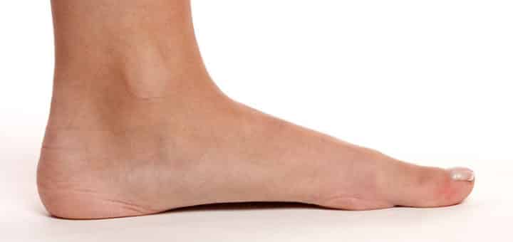 Shoes for Flat Feet Featured Image