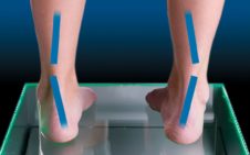 Under Pronation Supination