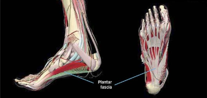 Adidas for PLantar Fasciitis